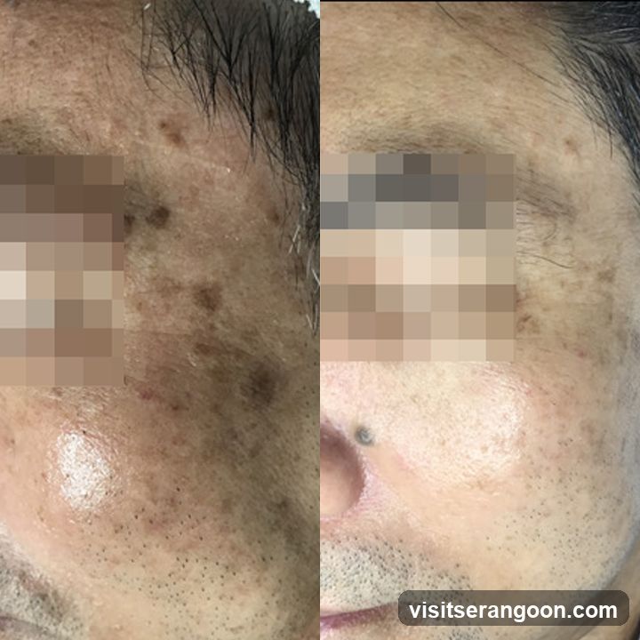 New York Skin Solutions - NEX | No.1 Facial Treatment Expert | Acne, Wrinkles & Pigmentation Solution