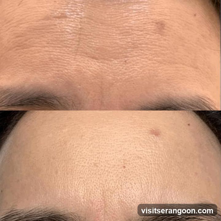 New York Skin Solutions - NEX | No.1 Facial Treatment Expert | Acne, Wrinkles & Pigmentation Solution