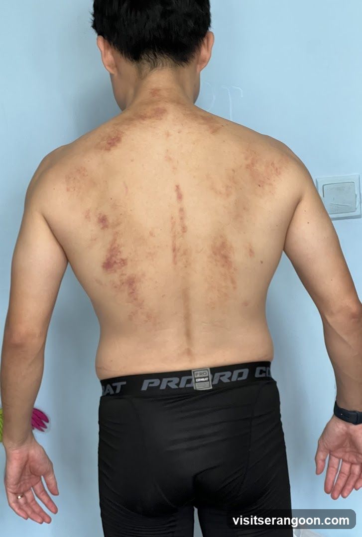 Joyre TCMedi Spa - Serangoon Nex Branch