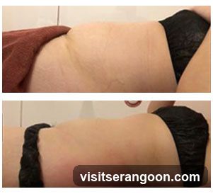 London Weight Management - NEX | SG's #1 Weight Loss & Slimming Expert | Burn Stubborn Fat in 30 Mins