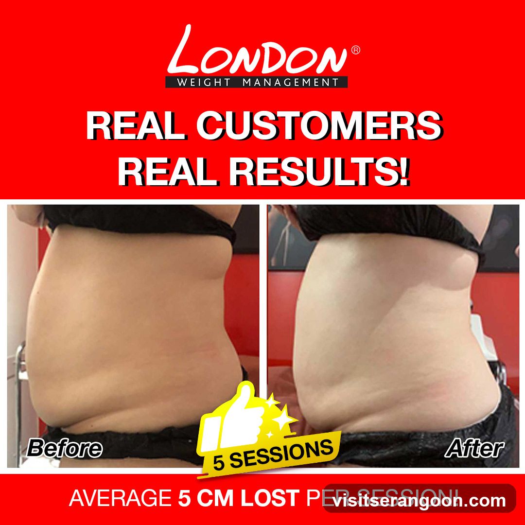 London Weight Management - NEX | SG's #1 Weight Loss & Slimming Expert | Burn Stubborn Fat in 30 Mins