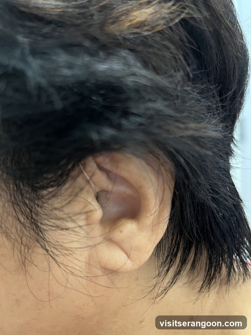 Amazing Hearing, Serangoon NEX Hearing Test, Hearing Aids and Tinnitus