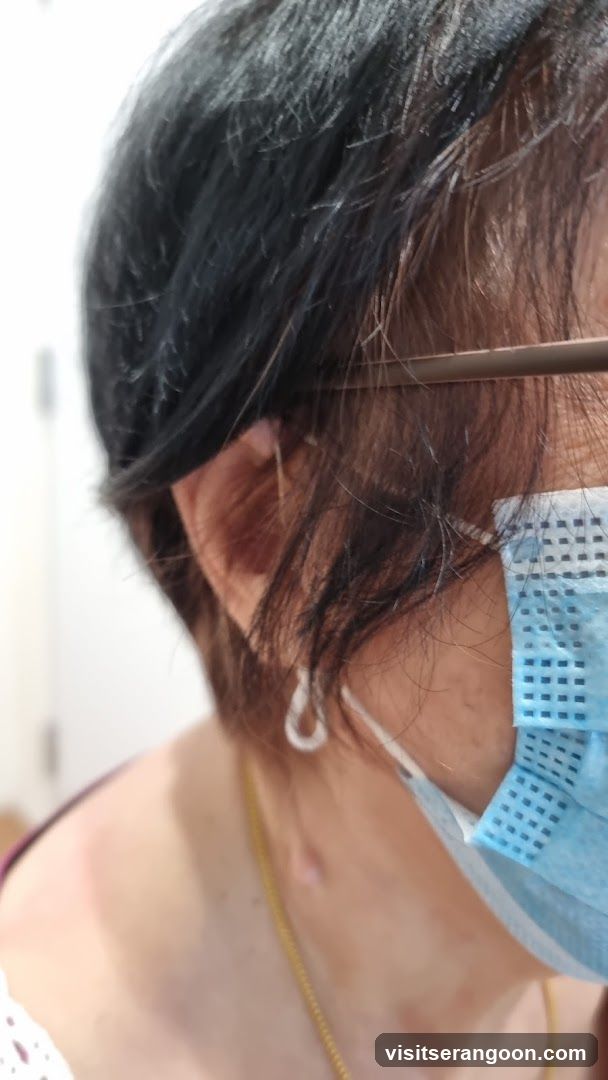 Amazing Hearing, Serangoon NEX Hearing Test, Hearing Aids and Tinnitus