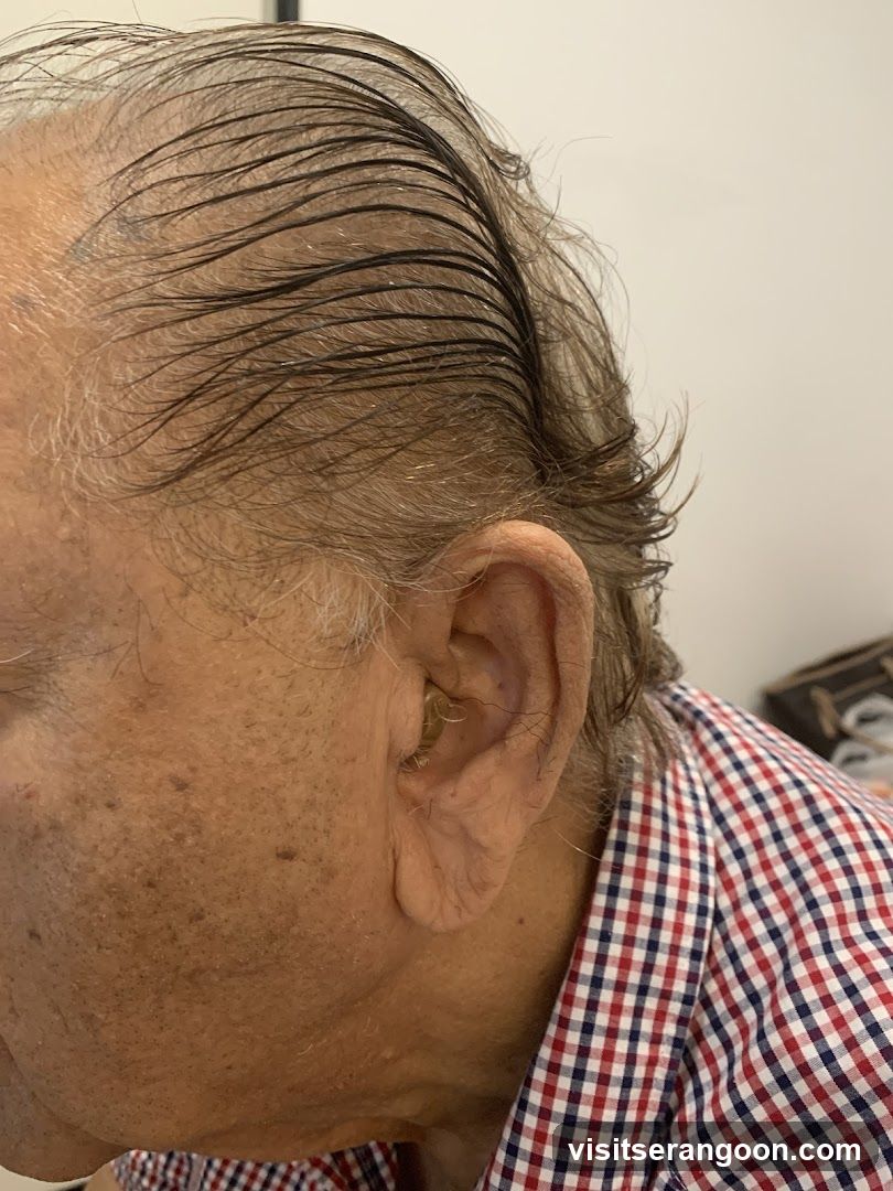 Amazing Hearing, Serangoon NEX Hearing Test, Hearing Aids and Tinnitus