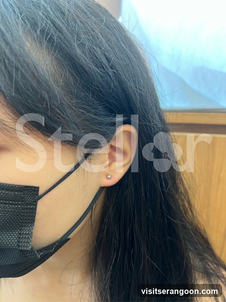 Stellar @ NEX (Ear Piercing & Jewellery)