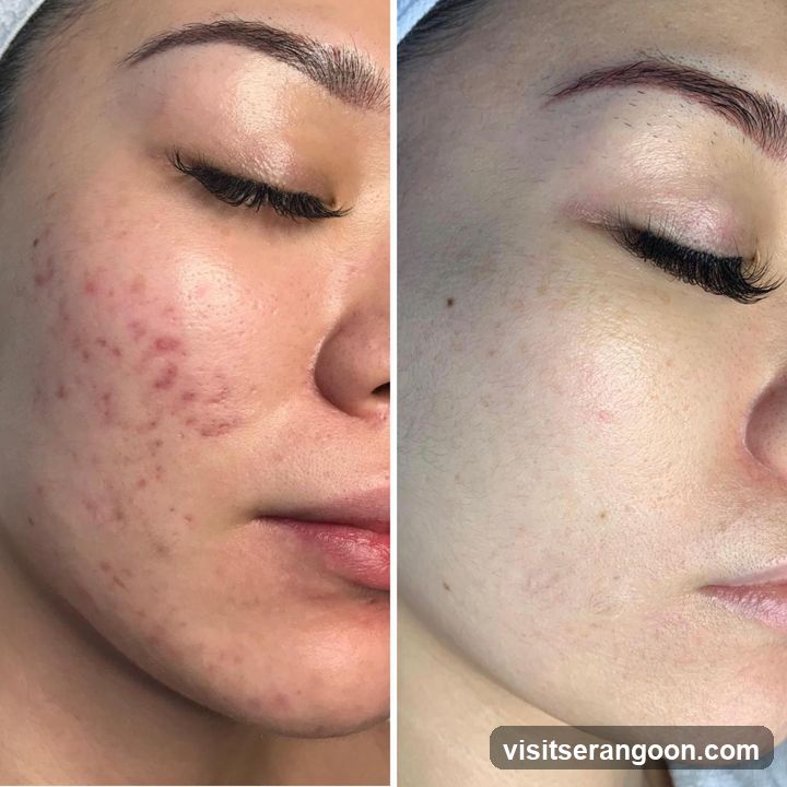 New York Skin Solutions - NEX | No.1 Facial Treatment Expert | Acne, Wrinkles & Pigmentation Solution